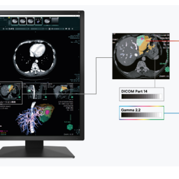 Monitor de Grado Medico